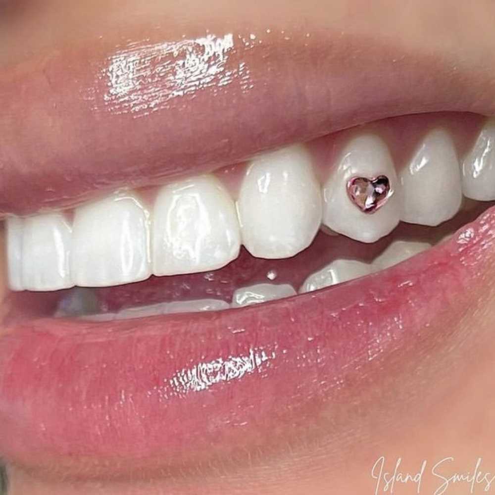 Bedazzling Smiles One Tooth At A Time. #boston #brighton #gem #gems #