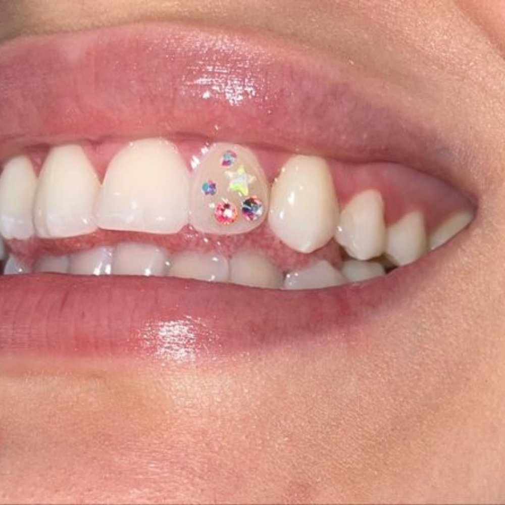 Tooth Gem Boston Services | Holistic Ink